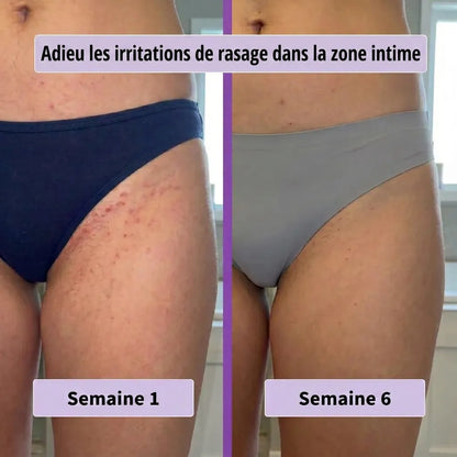 Pureskin™ Sérum Inhibiteur de Pousse de Poils