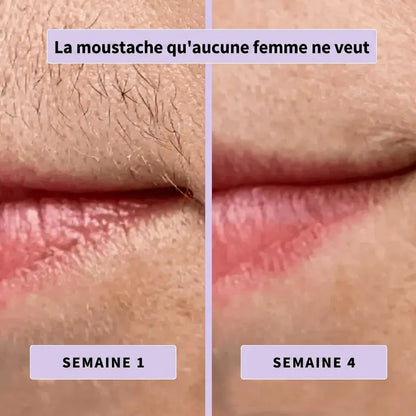 Pureskin™ Sérum Inhibiteur de Pousse de Poils