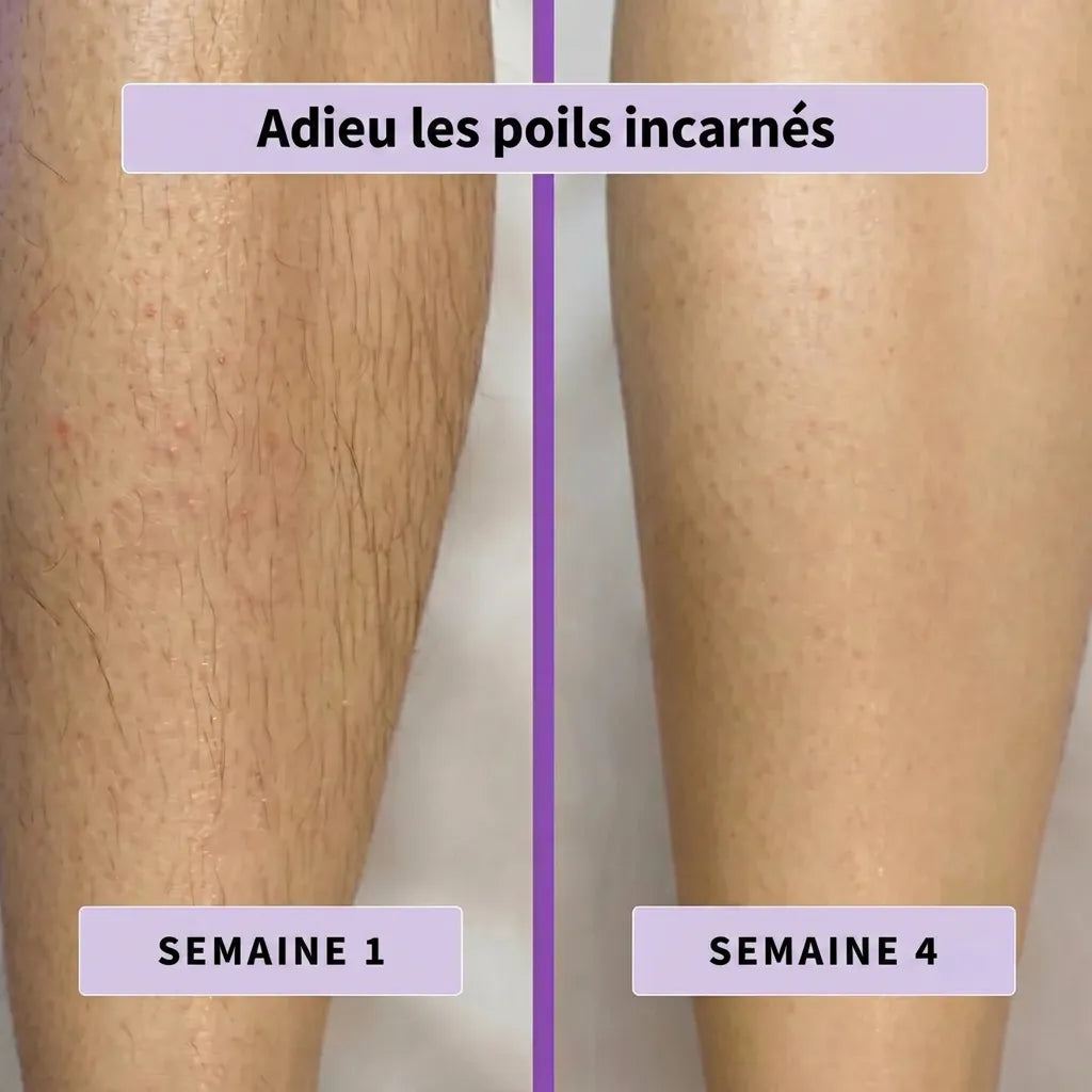 Pureskin™ Sérum Inhibiteur de Pousse de Poils