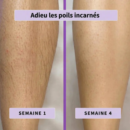 Pureskin™ Sérum Inhibiteur de Pousse de Poils